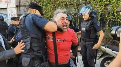 La Policía hirió y detuvo a un camarógrafo de A24 frente al Congreso